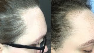 How To Microblade Your Own Hairline VERY EASY [upl. by Eiggep]