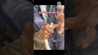 उंगली ही काट ली साप ने ytshorts shorts youtubeshorts shortvideo manojsnakesever [upl. by Olympia653]