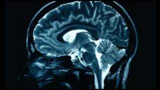 Why Religion causes brain damage [upl. by Lewie]