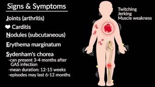 Acute Rheumatic Fever by E Rusingiza  OPENPediatrics [upl. by Gaylor]