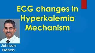 ECG changes in Hyperkalemia  Mechanism [upl. by Jablon]