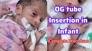 OG TUBE INSERTION IN INFANT COMPLETE PROCEDURE😲😲😲 [upl. by Armil343]