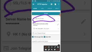 HTTP INJECTORZW SETTINGSNETONE USERS [upl. by Fairleigh]