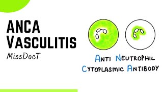 ANCA Vasculitis pathology [upl. by Vidovik499]