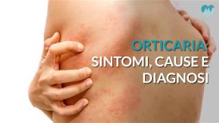 Orticaria sintomi cause e diagnosi [upl. by Suzette277]