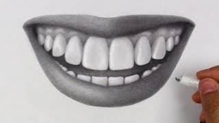 How to Fix a Gummy Smile In Just 10 Seconds [upl. by Caswell]