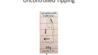 Orthodontic Tooth Movement Biomechanics Types of Movement [upl. by Nored571]