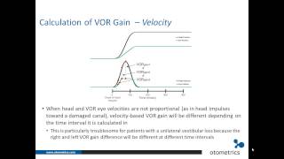 ICS Impulse vHIT Interpretation of test results [upl. by Attezi]