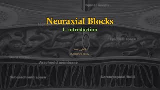 NAB Introduction to Neuraxial Blocks AR [upl. by Winston]