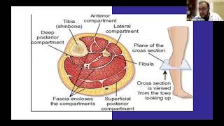 Rabdomiolisis en la emergencia Dr Gaston Keell [upl. by Rinna]