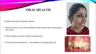 Management of Class II Div 1 malocclusion [upl. by Galliett558]