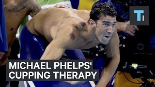 Michael Phelps cupping therapy [upl. by Livy]