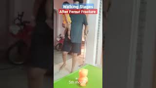 Walking Stages 👩‍🦽🧑‍🦯🚶🏃‍♂️ after Femur fracture shorts unstoppable legfracture femur [upl. by Fulton140]