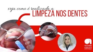 O que é profilaxia antibiótica Como é feito  Resumos de Odonto [upl. by Emsoc]