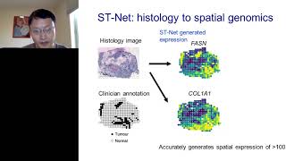 Deep learning to integrate histology with spatial transcriptomics [upl. by Kayley]