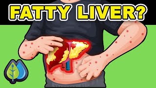 The BEST Way to DETOX Fatty Liver Naturally [upl. by Malinin]