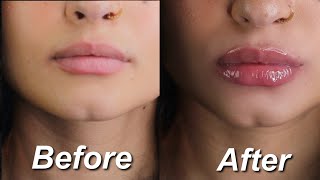 The BEST at home lip plumping mask 💋ONLY 3 INGREDIENTS insane results [upl. by Drahcir727]