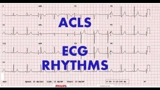 ACLS  ECG rhythm recognition amp management Part 1 [upl. by Aryad]