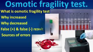 Osmotic fragility testOsmoticfragilitytestHematologyMLSHematologytests [upl. by Atkins]