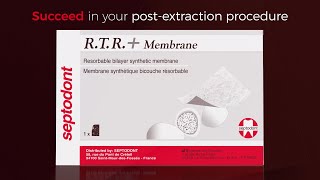 The effortless placement of RTR Membrane [upl. by Trix]