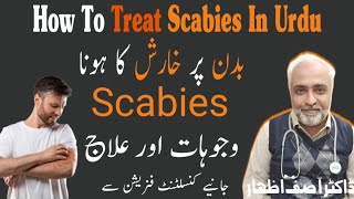 How to treat scabies  scabies treatment at home  Kharish ka ilaj  Scabies Treatment in urdu [upl. by Nawram]