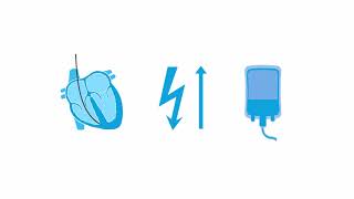 Transvenous pacing troubleshooting [upl. by Ellah851]