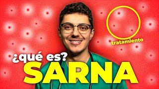 🔥 ¿QUÉ ES LA SARNA Como CURAR la ESCABIOSIS o SARNA [upl. by Ynnol]