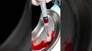 FLUTD ai Hematuria [upl. by Cleaves]