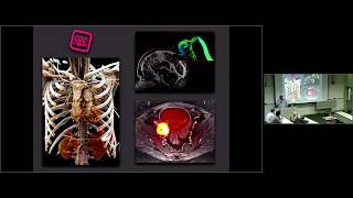 Basics of Radiology Modalities [upl. by Lleynod120]