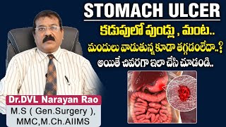 కడుపులో పుండ్లు  మంట  How to get relief from Stomach Ulcer  Dr DVL Narayan Rao  TX Hospitals [upl. by Drobman702]