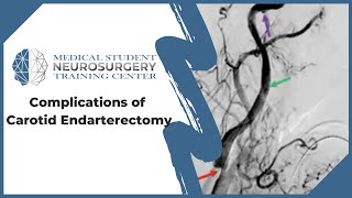 Superior Vena Cava SVC Syndrome  Pancoast Tumor  Pathology  Oncology  5MinuteReview [upl. by Augustine464]