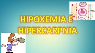 HIPOXEMIA E HIPERCAPNIA [upl. by Stoddard]