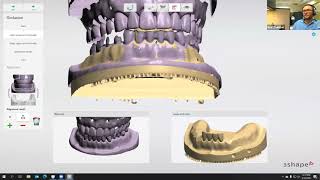 Digital Dentistry Training Series Advanced Denture Design [upl. by Ynad]