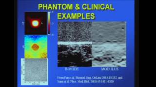 Principles of Elastography [upl. by Ginder]