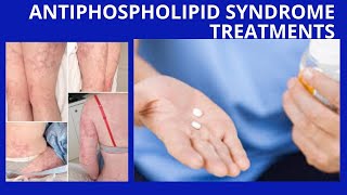 Antiphospholipid Syndrome Treatments [upl. by Ttereve]