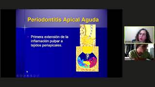 Periodontitis Apical AgudaAbsceso Fenix PART 1 [upl. by Ailesor436]