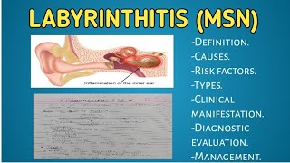 LABYRINTHITIS msn B Sc nursing nursing msn education nursingdegree [upl. by Harihat]