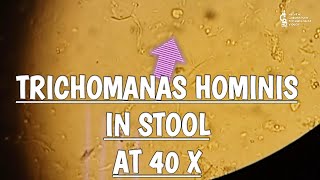 Trichomonas Hominis in stool microscopy at 40X [upl. by Yecrad]