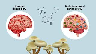 Psilocybin may ‘reset’ the brain to help manage treatmentresistant depression [upl. by Attirb]