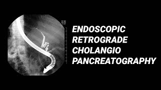 ERCP vs MRCP [upl. by Aleuqahs]