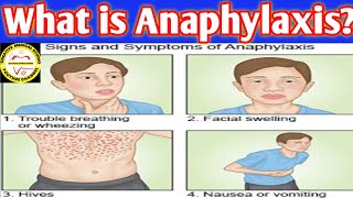 Anaphylaxis Causes symptoms mangment pathophysiology [upl. by Sarine912]