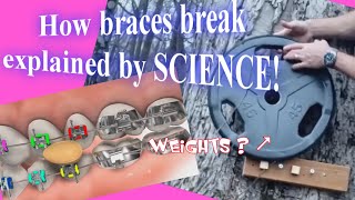 How do braces break Explained by SCIENCE [upl. by Ken]