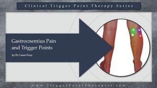 Gastrocnemius Pain and Trigger Points [upl. by Koloski]