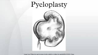 Pyeloplasty [upl. by Repsihw728]