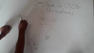 ECG interpretation très facile de LECG 2ème partie [upl. by Velma]