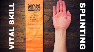 Fundamentals of Splinting [upl. by Davy]