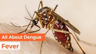 Dengue l Dengue Fever l Dengue Hemorrhagic Fever Symptoms Rashes Diagnosis Management Lecture [upl. by Aenit]