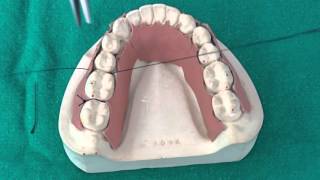 Peridontal Suturing Techniques [upl. by Yaniv121]