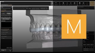 Bite Splints software module for ZirkonzahnModellier  ZirkonzahnSoftware [upl. by Lahcym]