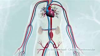 CIRURGIA ENDOVASCULAR DE ANEURISMA DA AORTA ABDOMINAL [upl. by Etom392]